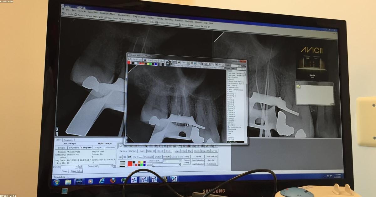 Podcast et narration : pourquoi le format audio captive autant